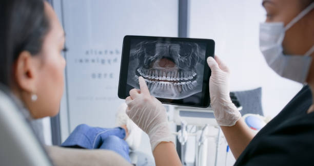 Emergency Dental Filling Replacement in LA