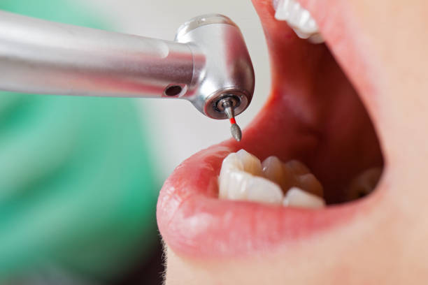 Best Urgent Tooth Repair  in Boyce, LA